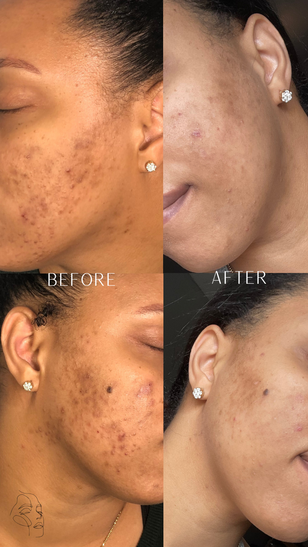 Client Results, Before & After